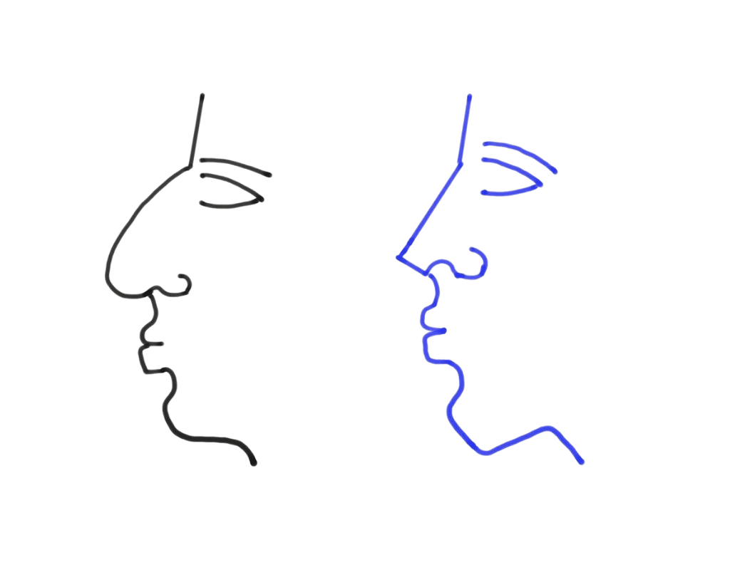 Rhinoplasty